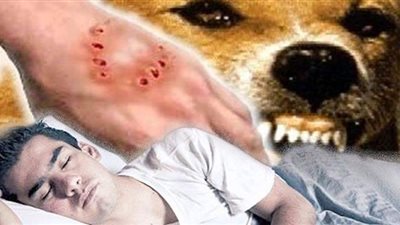 تفسير حلم عضة الكلب في المنام وعلاقته بالظلم والقهر وانتصار الأعداء