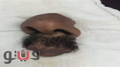 بسبب الميراث.. شاب يقطع أنف وشفاه عمه بالغربية