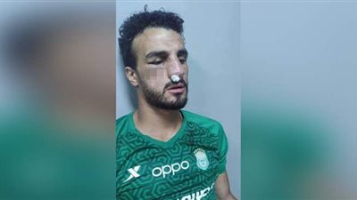 احمد فتحي يطمئن على مدافع الاتحاد بعد إصابته بكسر في الأنف