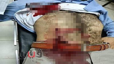 مجهولون يقتحمون مكتب محامٍ ويعتدون عليه بالضرب في الشرقية | صور