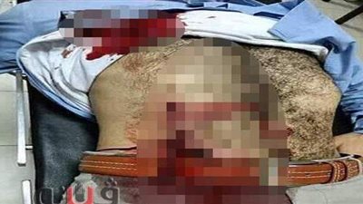 ضبط أحد مرتكبي واقعة الاعتداء على محام بالشرقية | صور