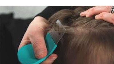 تفسير حلم القمل في المنام وعلاقته بالتخلص من الهموم والمشاكل