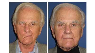 أعراض الإصابة بـ