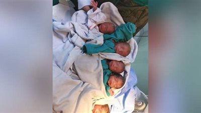 سيدة مصابة بتسمم تضع ٥ توائم في مستشفى قنا الجامعي