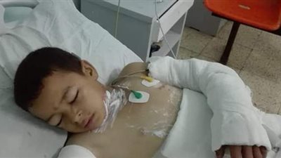 النيابة تقرر إيداع المتهمين بحرق طفل المنوفية بدار رعاية