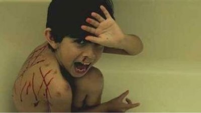 التحقيق مع سيدة تسيئ معاملة طفلين شقيقين سوادنيي الجنسية