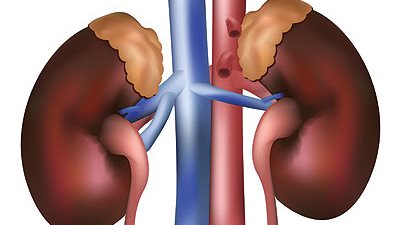 8 أعراض تؤكد إصابة طفلك بأمراض الكلى