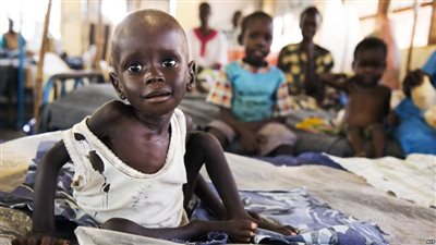 الأمم المتحدة: 20 مليونا يواجهون المجاعة بسبب الحرب