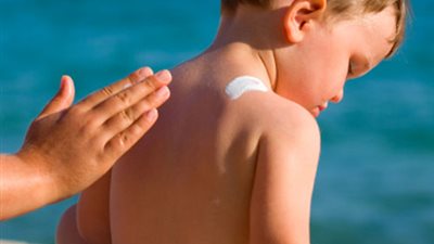 استشاري جلدية: 5 خطوات تجنبك حروق الشمس وجفاف الشعر