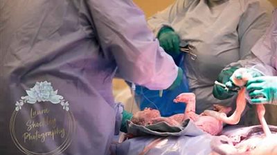 رد فعل جنين ولد بعد 4 أيام من آلام الوضع (صور)