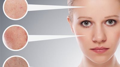 طريقة طبيعية لضمان جمال البشرة