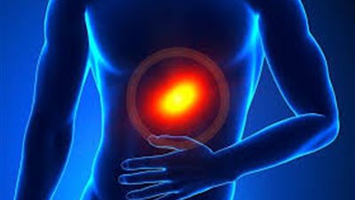 10 نصائح تخفف من حرقة المعدة