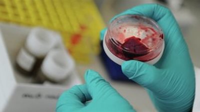 إجراء دراسة عن فيروس كورونا بمختبر الأبحاث البيطري المركزي