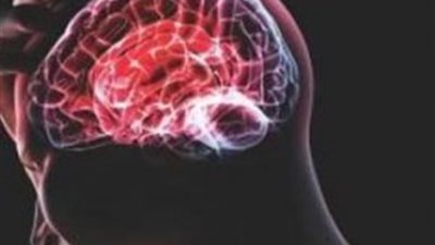 تجميد العصب يحمل إشارات الجوع للمخ لفقدان الوزن الزائد