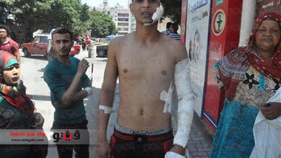 بالفيديو والصور.. «فيتو» تلتقي ضحية تعذيب «الإرهابية» بالإسكندرية