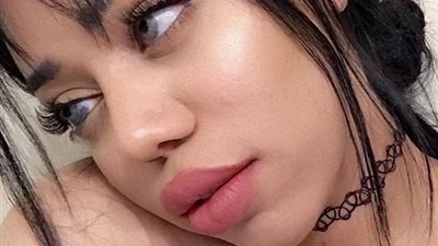 بالصور.. فتاة تصف متابعيها بالوقاحة بسبب «وحمة» بعينها