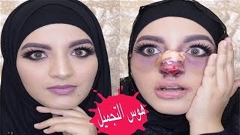 فيتو