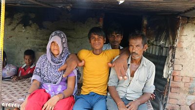 بالصور.. صبي يحصل على لقب الشيطان بسبب غرابة يديه