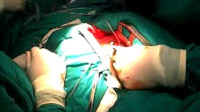 تفاصيل سرقة جراح شهير لكلية سيدة بالبحيرة