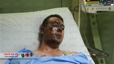 بالفيديو والصور.. أحد حراس وزير الداخلية يروي تفاصيل محاولة الاغتيال