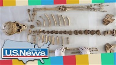 بالفيديو.. اكتشاف أول هيكل عظمي لشخص مصاب بالجذام قبل الميلاد