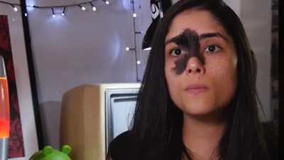 فتاة تستغل وحمتها الغريبة لتصبح عارضة أزياء (فيديو)