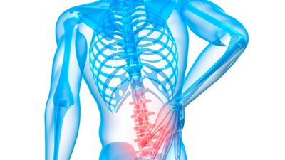 إهمال علاج الإنزلاق الغضروفي يسبب الضعف الجنسي للرجال