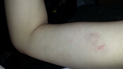 ميريهان حسين عن «إصابتها»: العين صابتني ورب العرش نجاني