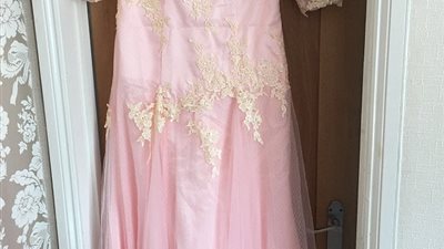 بالصور.. صدمة فتاة بعد شرائها فستان حفل تخرجها عبر الإنترنت