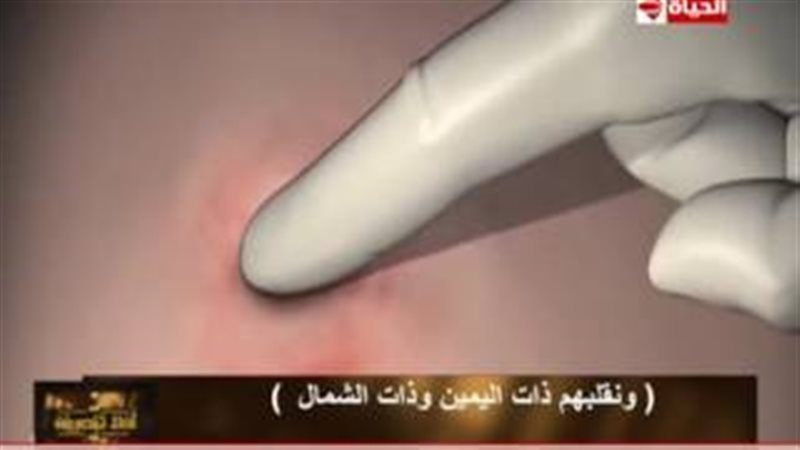 فيتو