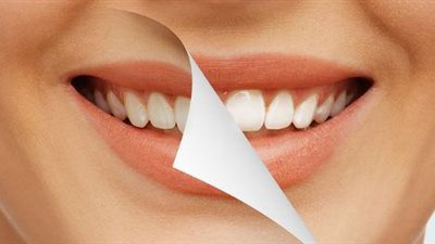 أسباب ومخاطر الإصابة بانحسار اللثة