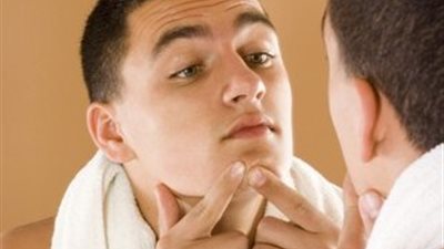 نصائح صيفية للقضاء على «حب الشباب»