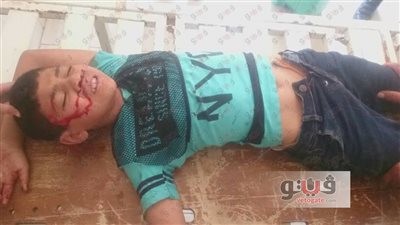 مصرع 3 وإصابة 17 في حوادث متفرقة بالشرقية