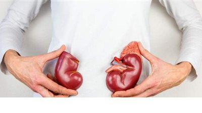 استشارى كلى: ارتفاع الكرياتينين بالدم دليل على وجود خلل بالكلى