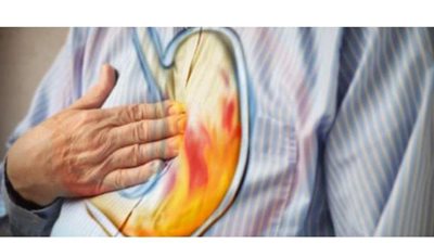 كل ما تريد معرفته عن أسباب الإصابة بالحموضة وأعراضها وطرق العلاج