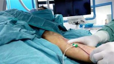 مستشفى المنصورة العام الجديد ينجح في إجراء جراحة نادرة