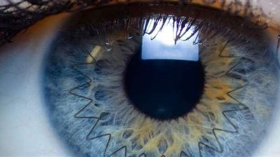 تفاصيل إجراء عمليات زرع قرنية بالتأمين الصحي الشامل