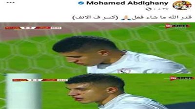 إصابة محمد عبد الغني بكسر في الأنف