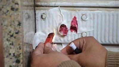 إغلاق 8 مراكز علاج طبيعي غير مرخصة بالغربية