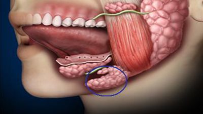 أسباب وأعراض اضطرابات «الغدة اللعابية» وطرق العلاج