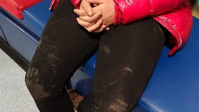 ضرب فتاة من زملائها بسبب لون بشرتها (فيديو وصور )