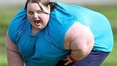 7 أسباب تؤدى إلى الإصابة بالسمنة المفرطة