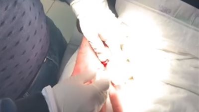 أحمد الشناوي ينشر فيديو من داخل المستشفى لإجرائه جراحة في يده