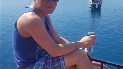 بالصور.. حروق لرجل نام وترك «الأيفون» على صدره