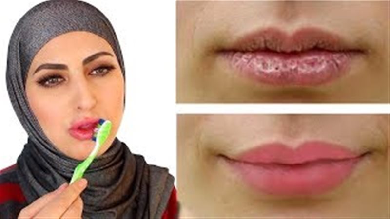 فيتو