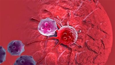 وداعًا للسرطان.. «البذرة المعدنية» تدمر الأورام في 10 دقائق