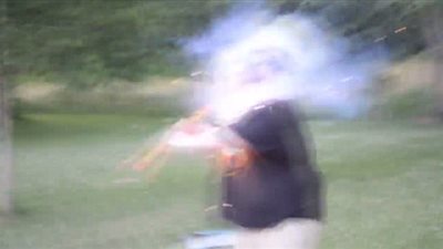 بالفيديو والصور.. رجل يفجر لعبة نارية في وجهه