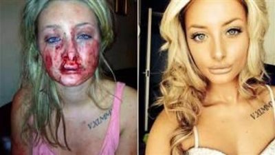 «الغيرة» تدفع شابا للاعتداء على حبيبته بطريقة وحشية