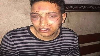 ضابط الألف مسكن: «السائق وزملاؤه اعتدوا عليا بالضرب المبرح»