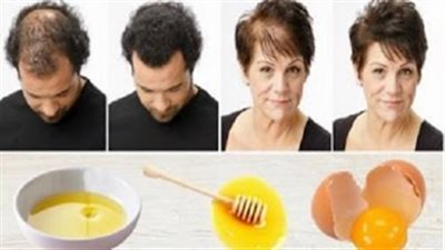 بالفيديو.. وصفة سحرية لعلاج تساقط الشعر